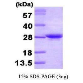 NBP1-30197